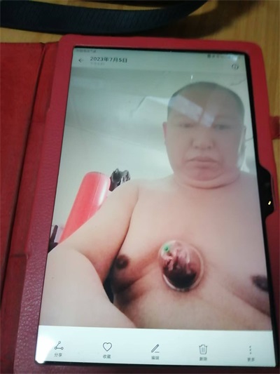 关于《五脏六腑》中医药技术修复