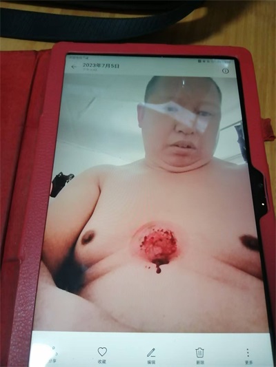 关于《五脏六腑》中医药技术修复