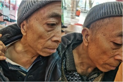 痔疮鼻炎无效退款，广西百色杨忠雅医师