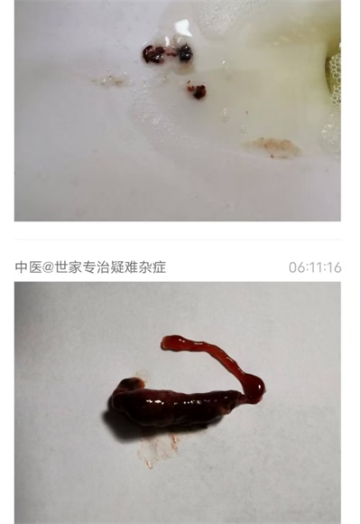 八一建军节98周年专题报道 清代御医第四代传人——黎化雨