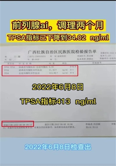 金秀瑶族灯草灸疗法 瑶医药非物质文化遗产传承人---赵衷民