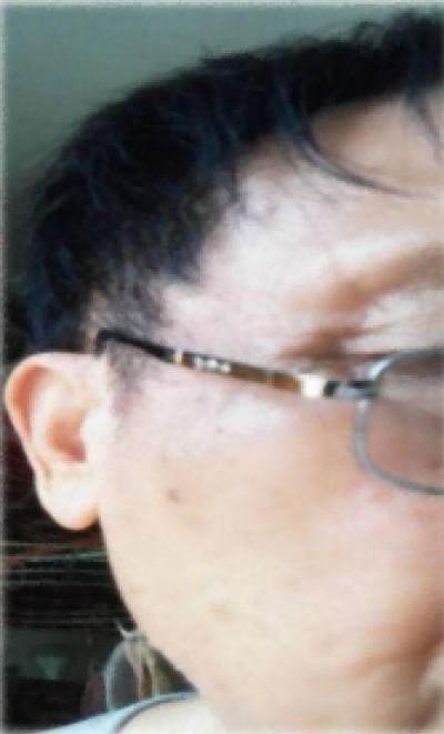 现代科技量氢氧元素绿色自然疗法！(廖永贵院士)