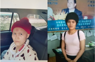 广西百色市杨忠雅治疗各种癌症有成就